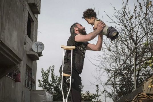 Italy gives refuge to Syrian father and limbless son in famed photo